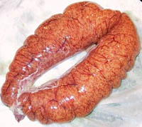 shad roe